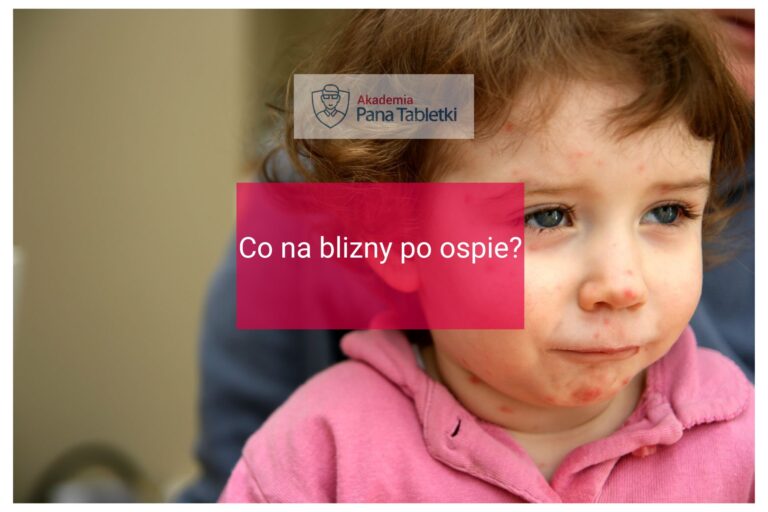 Co na blizny po ospie? - Pan Tabletka - Pan Tabletka